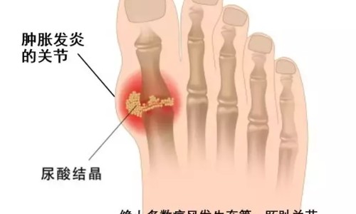 直肠指检自己能做吗-直肠指检效果网 - 为你提供直肠指检摸到肿瘤什么感觉、直肠指检对身体有害吗